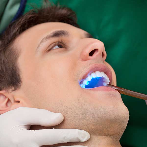 Tooth Bonding | Health Plus Dental